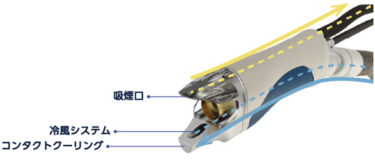 スプレンダーX - 医療脱毛機器の画像