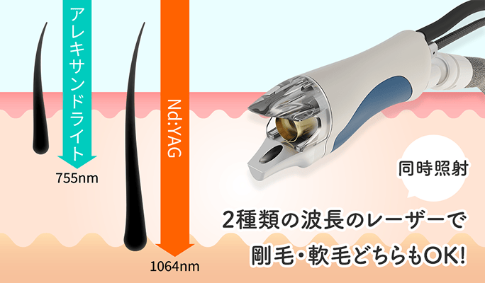 2種類の波長のレーザーで剛毛・軟毛どちらもOK!